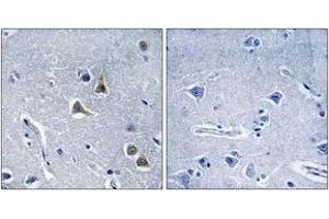 Immunohistochemistry analysis of paraffin-embedded human brain tissue, using ARRDC2 Antibody. (ARRDC2 Antikörper  (AA 141-190))