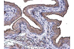 Immunohistochemistry (IHC) image for anti-Keratin 20 (KRT20) antibody (ABIN2856768)