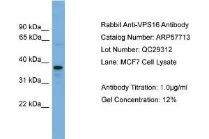 WB Suggested Anti-VPS16  Antibody Titration: 0. (VPS16 Antikörper  (N-Term))