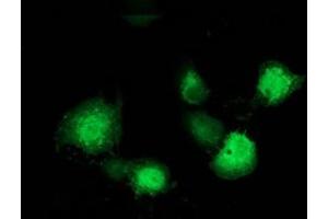 Immunofluorescence (IF) image for anti-Microtubule-Associated Protein, RP/EB Family, Member 2 (MAPRE2) antibody (ABIN1499317) (MAPRE2 Antikörper)