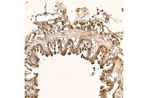 Immunohistochemistry of paraffin-embedded rat lung using [KO Validated]  Rabbit mAb (ABIN7271243) at dilution of 1:100 (40x lens). (AKT1 Antikörper)