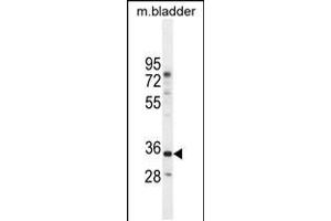 Western blot analysis in mouse bladder tissue lysates (35ug/lane). (C17orf59 Antikörper  (AA 186-215))