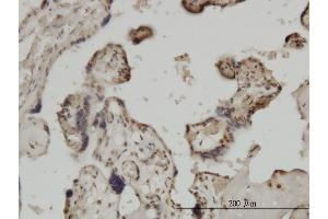 Immunoperoxidase of monoclonal antibody to ZIC4 on formalin-fixed paraffin-embedded human placenta. (ZIC4 Antikörper  (AA 249-319))