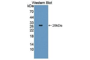 Western Blotting (WB) image for anti-Selectin E (SELE) (AA 23-240) antibody (ABIN1870715)