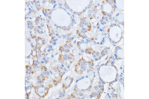 Immunohistochemistry (IHC) image for anti-Ral Guanine Nucleotide Dissociation Stimulator (RALGDS) antibody (ABIN7269838)