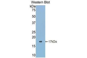 Western Blotting (WB) image for anti-Acid Phosphatase 1, Soluble (ACP1) (AA 40-158) antibody (ABIN1857871) (ACP1 Antikörper  (AA 40-158))