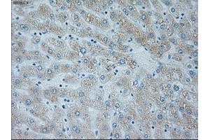 Immunohistochemical staining of paraffin-embedded lymph node tissue using anti-NEUROG1mouse monoclonal antibody. (Neurogenin 1 Antikörper)