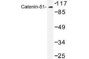Image no. 1 for anti-Catenin (Cadherin-Associated Protein), delta 1 (CTNND1) antibody (ABIN317789) (CTNND1 Antikörper)