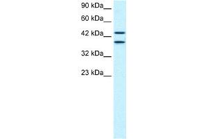 WB Suggested Anti-C14ORF131 Antibody Titration:  0. (ZNF839 Antikörper  (Middle Region))