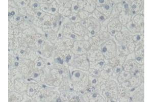 Immunohistochemistry (IHC) image for anti-Receptor Tyrosine Kinase-Like Orphan Receptor 2 (ROR2) (AA 683-934) antibody (ABIN7443737)