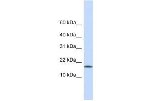 CENPA antibody used at 1 ug/ml to detect target protein. (CENPA Antikörper  (Middle Region))