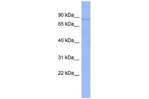 WB Suggested Anti-CNOT3 Antibody Titration:  0. (CNOT3 Antikörper  (C-Term))