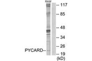 Western blot analysis of extracts from RAW264. (STS Antikörper  (AA 10-59))