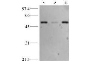 Western blotting using anti-p53. (p53 Antikörper)