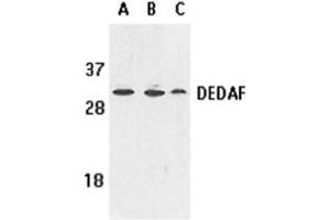 Western blot analysis of DEDAF expression in human A549 (lane A), HepG2 (lane B), and mouse 3T3 (lane C) cell lysates with AP30284PU-N DEDAF antibody at 1 μg /ml. (RYBP Antikörper)