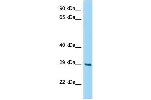 WB Suggested Anti-Fam122b Antibody Titration: 1. (FAM122B Antikörper  (N-Term))