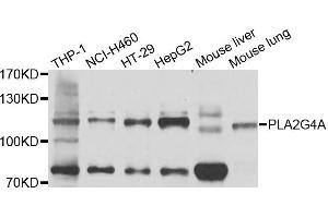 Western blot analysis of extracts of various cells, using PLA2G4A antibody. (PLA2G4A Antikörper)