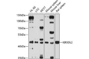 Western blot analysis of extracts of various cell lines, using KIR3DL2 antibody (ABIN6131968, ABIN6142888, ABIN6142889 and ABIN6214251) at 1:1000 dilution. (KIR3DL2 Antikörper  (AA 361-455))