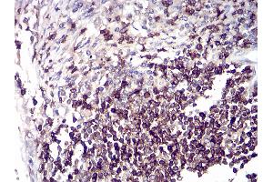 Immunohistochemistry (IHC) image for anti-CD6 (CD6) (AA 18-199) antibody (ABIN5542301)