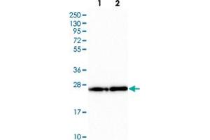 Western blot analysis of Lane 1: Human cell line RT-4 Lane 2: Human cell line U-251MG with PDAP1 polyclonal antibody  at 1:250-1:500 dilution. (PDAP1 Antikörper)
