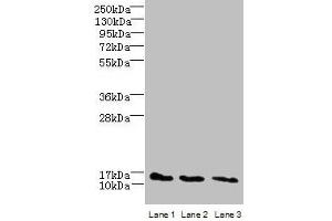 Western blot All lanes: C2orf15 antibody at 6 μg/mL Lane 1: U251 whole cell lysate Lane 2: MCF-7 whole cell lysate Lane 3: HCT116 whole cell lysate Secondary Goat polyclonal to rabbit IgG at 1/10000 dilution Predicted band size: 14 kDa Observed band size: 14 kDa (C2ORF15 Antikörper  (AA 1-125))
