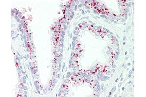 Anti-GAA antibody IHC staining of human prostate. (GAA Antikörper  (AA 174-203))