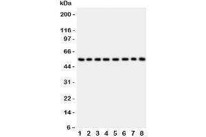 Western blot testing of P2X2 antibody and Lane 1:  rat brain;  2: mouse brain;  3: human placenta;  4: (h) HeLa;  5: (h) SHG-44;  6: (m) Neuro-2a;  7: (h) 22RV1;  8: (h) U87 lysate.