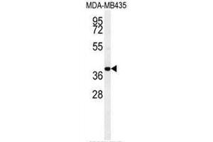 CCR8 Antibody (C-term) western blot analysis in MDA-MB435 cell line lysates (35µg/lane). (CCR8 Antikörper  (C-Term))