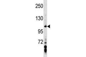 AXIN1 antibody western blot analysis in MDA-MB453 lysate. (Axin Antikörper  (AA 330-359))