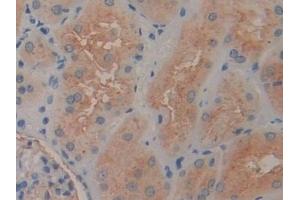 Immunohistochemistry (IHC) image for anti-Glutamyl Aminopeptidase (Aminopeptidase A) (ENPEP) (AA 718-948) antibody (ABIN7443356)
