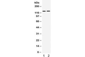 Western blot testing of human 1) SMMC and 2) 293 cell lysate with TRPM5 antibody. (TRPM5 Antikörper  (AA 1021-1108))