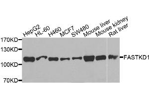 Western blot analysis of extracts of various cell lines, using FASTKD1 antibody. (FASTKD1 Antikörper  (AA 638-847))