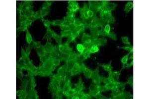 Immunofluorescence Microscopy of Rabbit Anti-Beta-2-microglobulin antibody. (beta-2 Microglobulin Antikörper  (HRP))