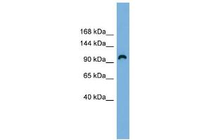 WB Suggested Anti-RAPGEF3 Antibody Titration: 0. (RAPGEF3 Antikörper  (Middle Region))
