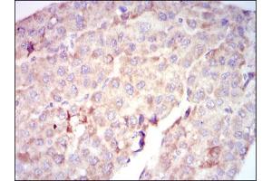 Image no. 2 for anti-V-Raf-1 Murine Leukemia Viral Oncogene Homolog 1 (RAF1) antibody (ABIN1500583) (RAF1 Antikörper)