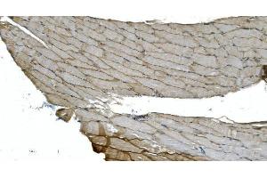 IHC analysis of H Cadherin/CDH13 using anti-H Cadherin/CDH13 antibody (ABIN7600095). (Cadherin 13 Antikörper  (AA 149-692))