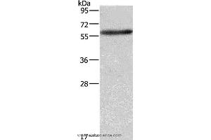 Western blot analysis of A172 cell, using AMIGO2 Polyclonal Antibody at dilution of 1:597 (AMIGO2 Antikörper)