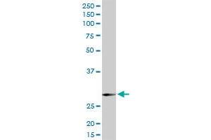 SNAP29 MaxPab rabbit polyclonal antibody. (SNAP29 Antikörper  (AA 1-258))