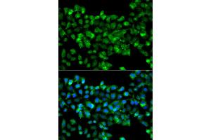 Immunofluorescence analysis of A549 cells using CBR3 antibody (ABIN5975603). (CBR3 Antikörper)