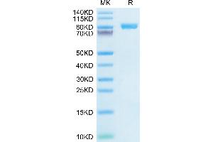 SDS-PAGE (SDS) image for Interleukin 6 Receptor, alpha (IL6RA) (AA 20-365) protein (Fc Tag) (ABIN7275024)