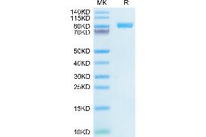 Human IL-6 R alpha on Tris-Bis PAGE under reduced condition. (IL6RA Protein (AA 20-365) (Fc Tag))
