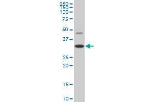 HOXD8 monoclonal antibody (M02), clone 3G8 Western Blot analysis of HOXD8 expression in HepG2 .
