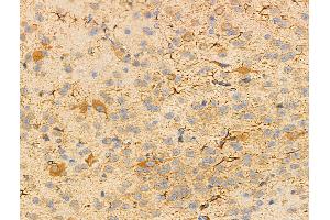ABIN6256878 and ABIN6274572 at 1/100 staining Mouse brain tissue by IHC-P. (Serotonin Receptor 2B Antikörper  (Internal Region))