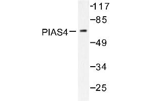 Image no. 2 for anti-Protein Inhibitor of Activated STAT, 4 (PIAS4) antibody (ABIN271954) (PIAS4 Antikörper)