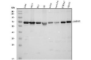 Western blot analysis of HNRNPL using anti-HNRNPL antibody (ABIN4886624). (HNRNPL Antikörper  (C-Term))
