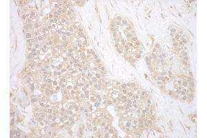 Immunohistochemistry (IHC) image for anti-BCL2-Associated Athanogene 3 (BAG3) (AA 300-350) antibody (ABIN7453661)