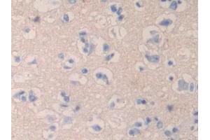 Used in DAB staining on fromalin fixed paraffin- embedded liver tissue (QSOX1 Antikörper  (AA 37-181))