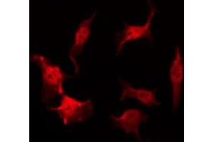 ABIN6269087 staining HeLa by IF/ICC. (HSP27 Antikörper  (Internal Region))