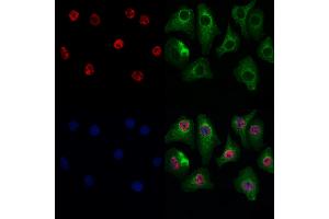 ABIN7093889 and ABIN7097932 staining Hela cells by IF/ICC. (GSTO2 Antikörper  (N-Term))