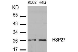Image no. 2 for anti-Heat Shock 27kDa Protein 1 (HSPB1) (AA 80-84) antibody (ABIN197490) (HSP27 Antikörper  (AA 80-84))